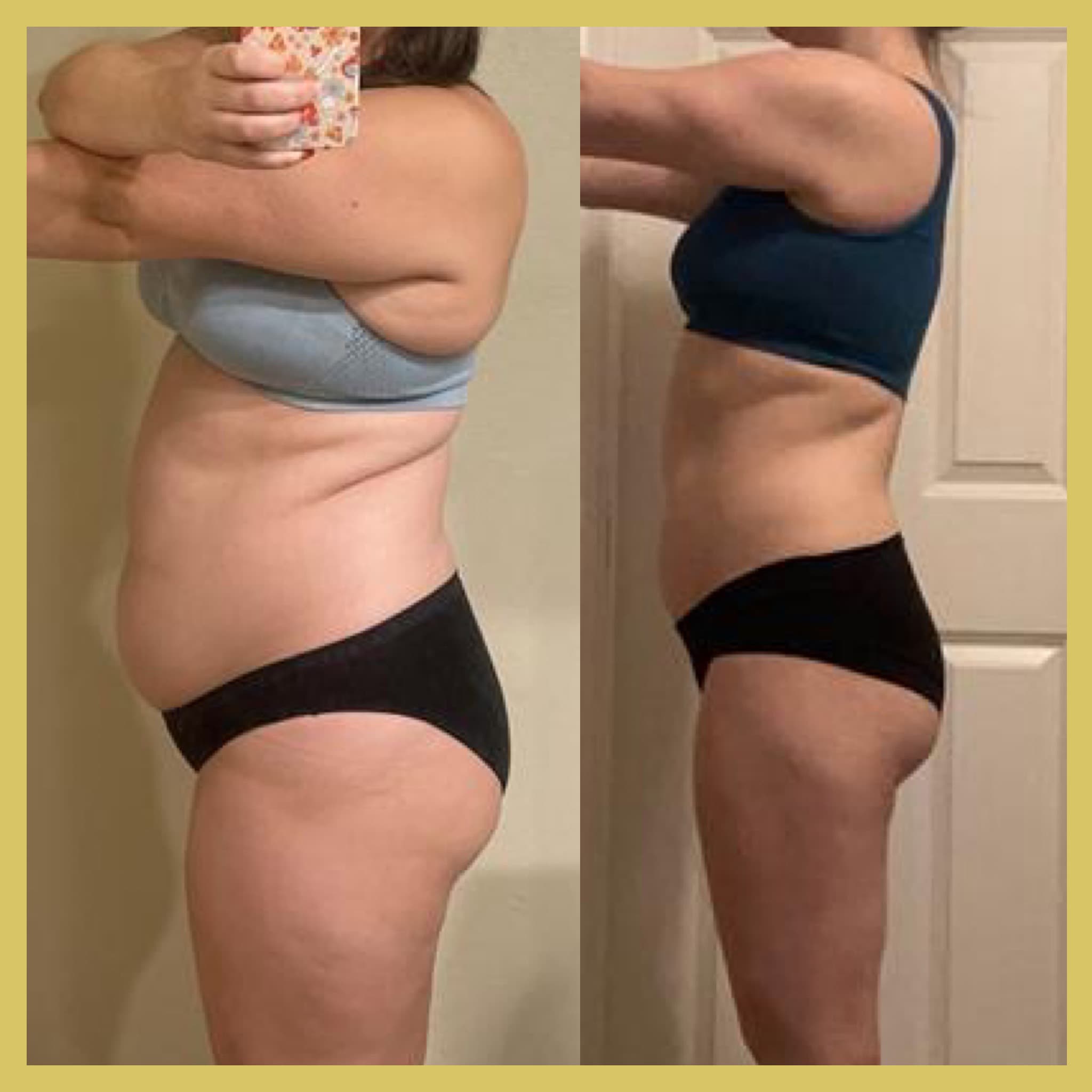 Down 38lbs With The Assistance Of GLP 1, Lifestyle Changes And Improving Her Relationship With Food 2